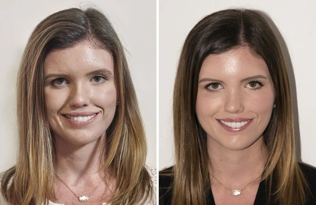 Before & After 2